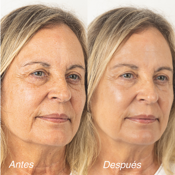 PROTECTOR SOLAR SUN FILTER