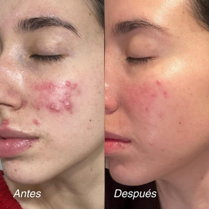 REDNESS CONTROL CREAM